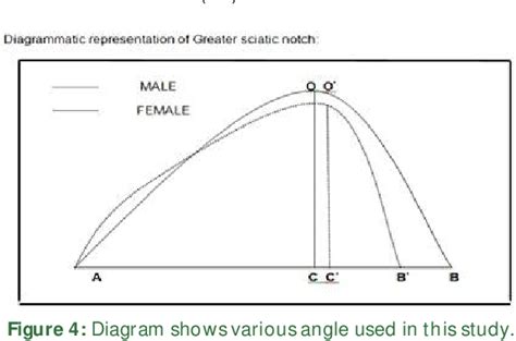 Figure 1 From Determination Of Sex From Greater Sciatic Notch Of Hip