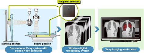 Dynamic Chest Radiography As A Novel Minimally Invasive Hemodynamic