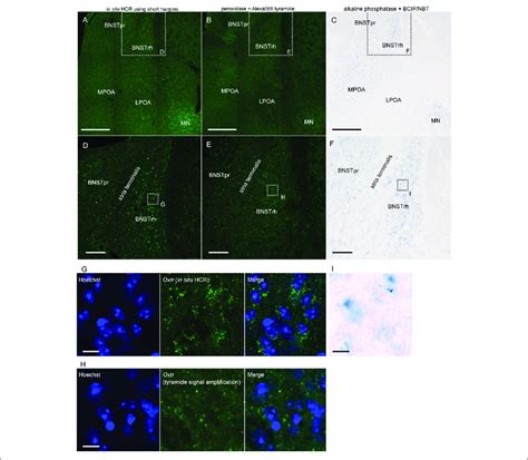 Detection Of Low Abundance MRNA Using In Situ HCR A D In Situ HCR