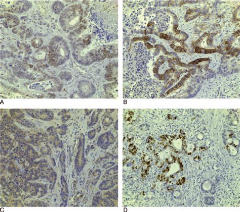 Typical Examples Of Immunohistochemistry Staining Characteristics Of