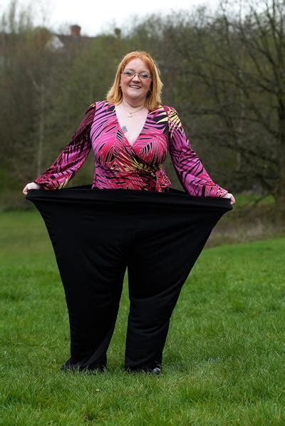 Dagensinn 190 Pound Weight Loss Is Recorded In The Guinness Book Of