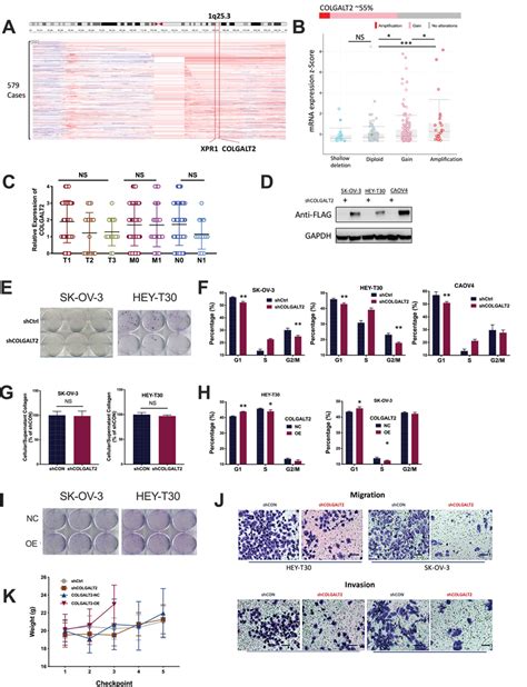 The Q Is Amplified In Ovarian Cancer Ovca And Targets Colgalt