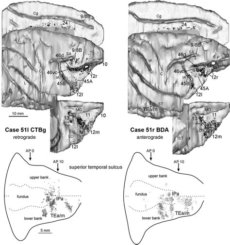 Distribution Of The Retrograde And Anterograde Labeling Observed In