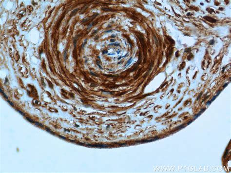 Pi4ka Antibody 12411 1 Ap Proteintech 武汉三鹰生物技术有限公司