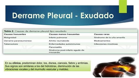 Derrame Pleural Y TEP Caracteristicas Generales PPT Descarga Gratuita