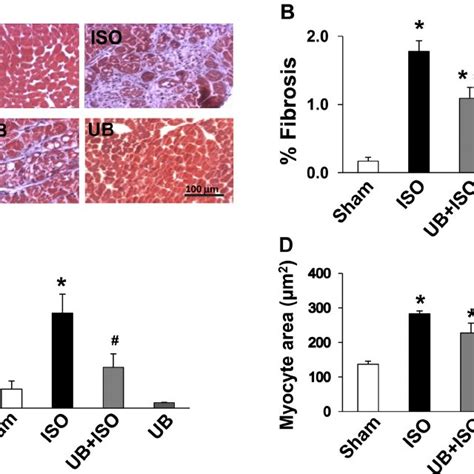 Expression Of MMP 9 And Tissue Inhibitor Of MMP 2 TIMP 2 In The