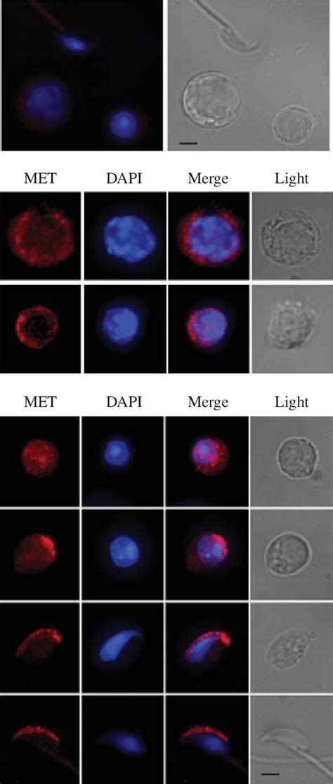 Met Redistributes In Spermatogenic Cells At Different Stages Of Cell