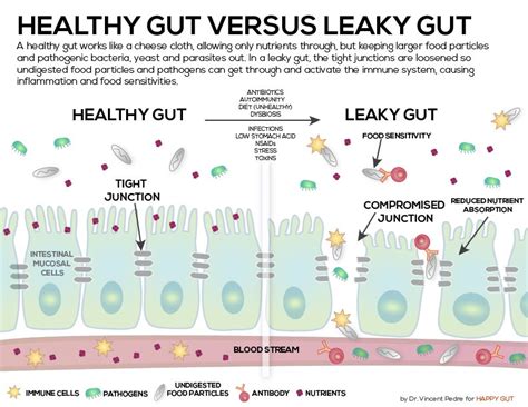 Ways To Check Your Gut Health Part Ii Soaring Forward