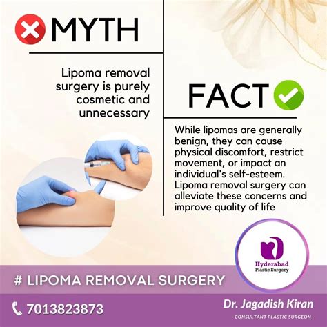 Experience Freedom Lipoma Surgery Remove The Lump Restore Your Confidence In 2024 Women