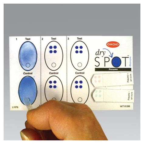 Thermo Scientific Dryspot Legionella Species Latex Agglutination Test