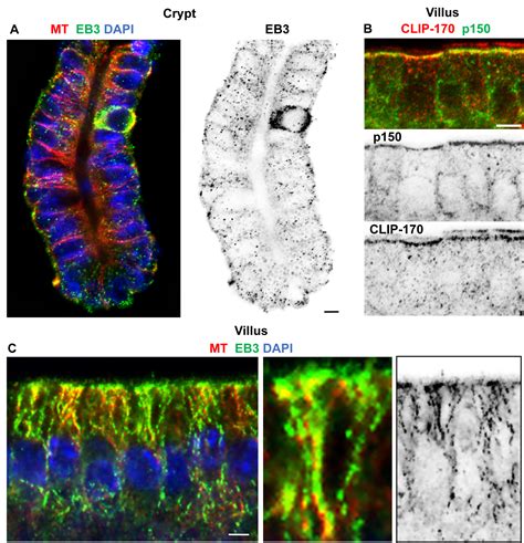 Immuno Fluorescent Labeling Of Microtubules And Centrosomal Proteins In