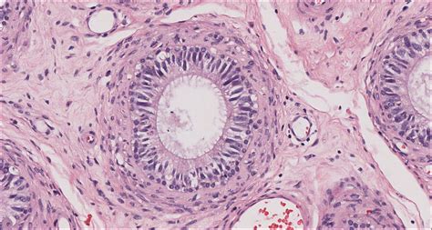 Testis And Epididymis Normal Histology Nus Pathweb Nus Pathweb