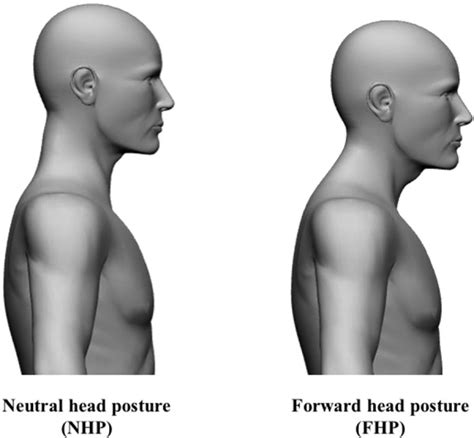 Effect Of Forward Head Posture On Thoracic Shape And Respiratory