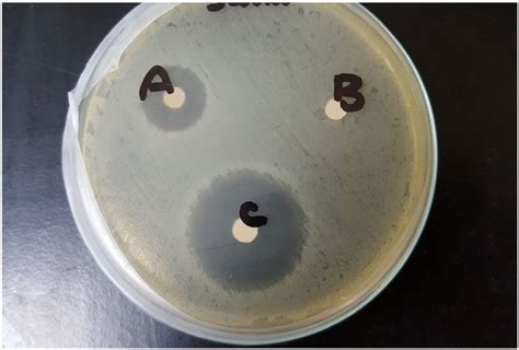 Disc Diffusion Antibiotic Sensitivity Test Against Staphylococcus