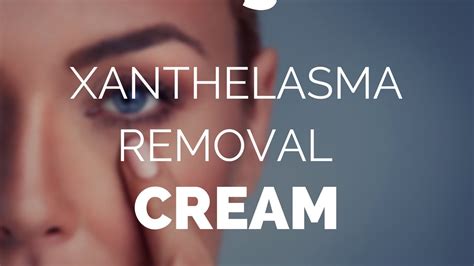 Xanthelasma Removal Cream Xanthel Xanthelasma Remover Youtube