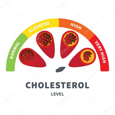 Diferentes Etapas De Acumulaci N De Placa De Colesterol En La Arteria