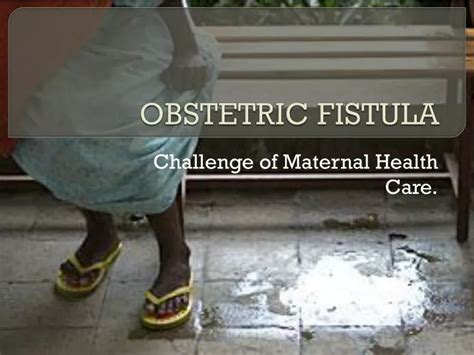 Ppt Obstetric Fistula Powerpoint Presentation Free Download Id2221388