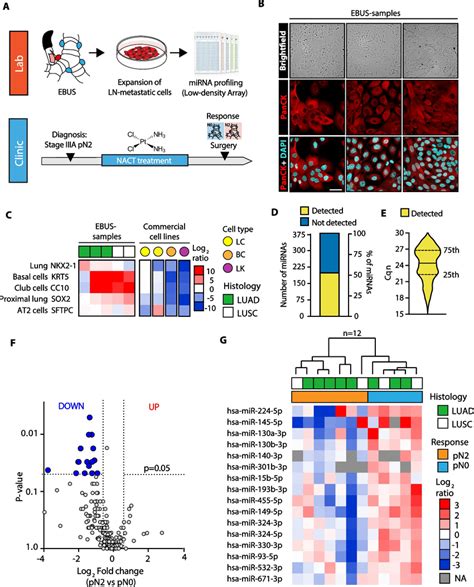 Mirna Expression Profiling Of Lnmets Collected By Ebus Tbna A Strategy Download Scientific