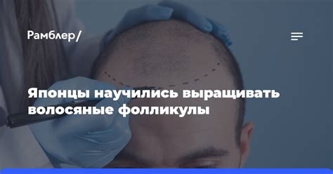 Японцы научились выращивать волосяные фолликулы - Рамблер/новости