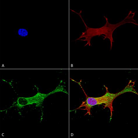 Anti Notch1 Antibody 56544 QED Bioscience Inc