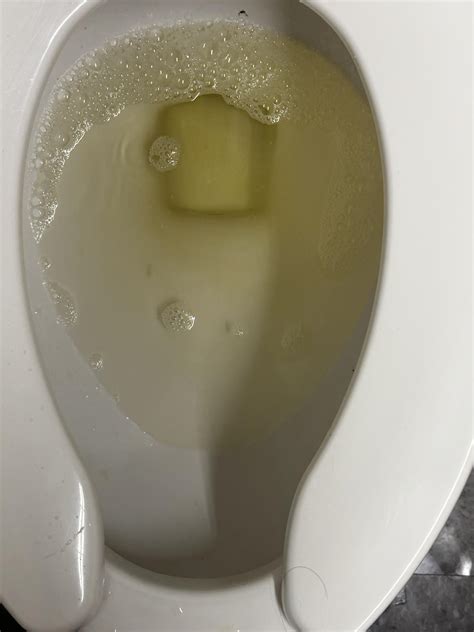 M 22 Is This Considered Foamy Urine Blood Test Are Normal Gpr 96