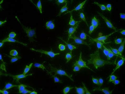 Anti-N-cadherin Antibodies | Invitrogen