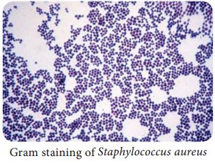 Medical Bacteriology Of Staphylococcus Aureus NCERT MCQ