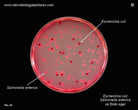 Salmonella Enterica Gram Stain