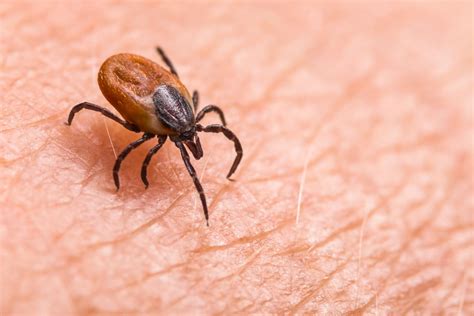 Lyme Disease Symptoms