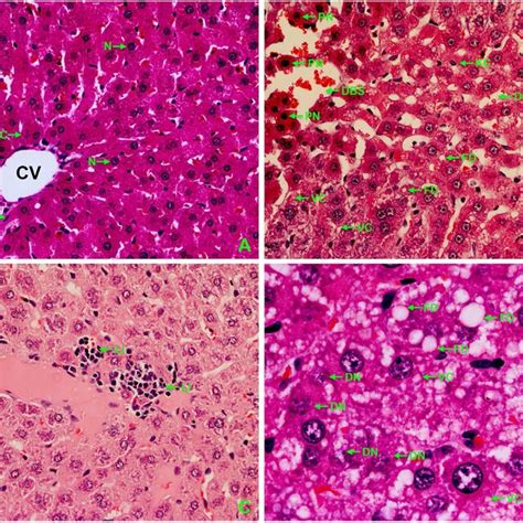 Histological Alterations In The Liver A Control B D Nio Nps 4 Download Scientific Diagram