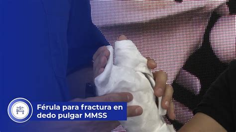 Férula para fractura en pulgar YouTube