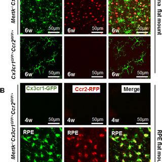 Retina And RPE Flat Mounts From Mertk Cx3cr1 GFP Ccr2 RFP Mice