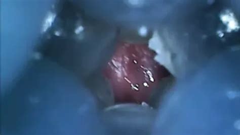 Free Internal Fleshlight Gay Porn Videos XHamster