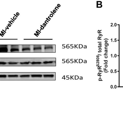 Dantrolene Significantly Decreases Phosphorylation Of Ryanodine