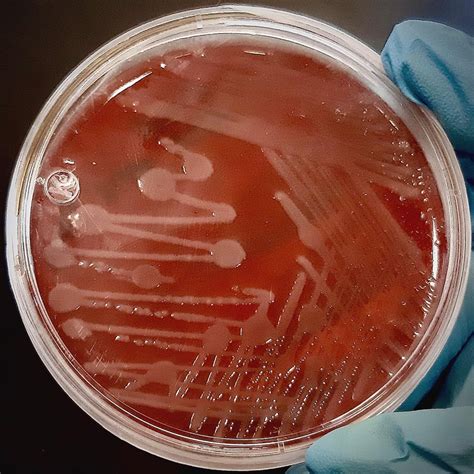 Anton Van Microbiology On Instagram Klebsiella Sp Blood Agar