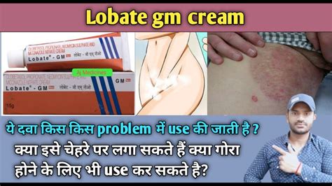 Lobate Gm Cream Use Dose Benefits And Side Effects Full Review In Hindi