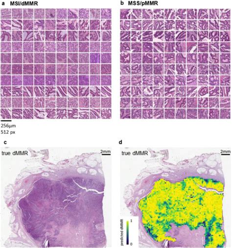 Deep Learning For The Detection Of Microsatellite Instability From