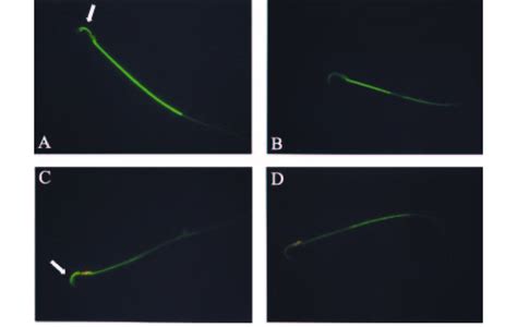 Acrosomal Status Assessed By Fluorescein Isothiocyanate Conjugated