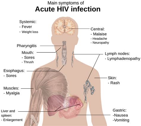 Hiv Clinical Features Management Teachmeobgyn