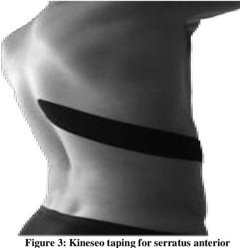 Figure From Immediate Effects Of Kinesio Taping On Upper Extremity