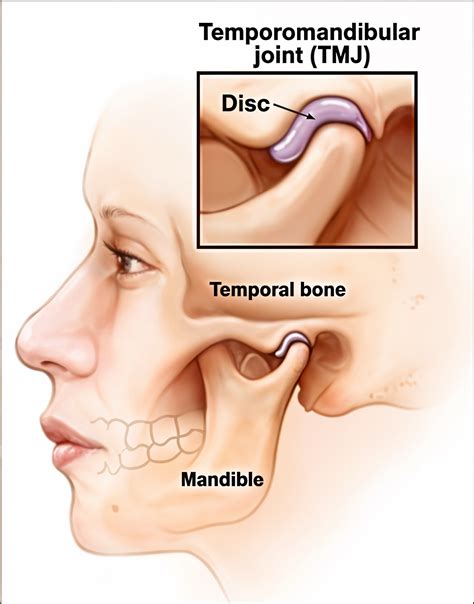 Understanding Temporomandibular Disorder (TMD) - Dental Lifeline