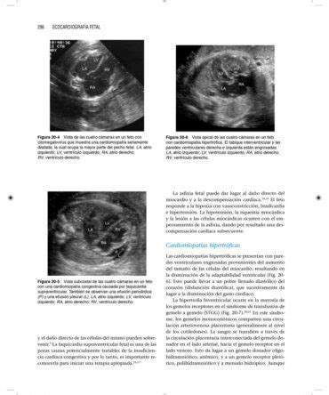 Libro Ecocardiograf A Fetal Era Edici N En Campus