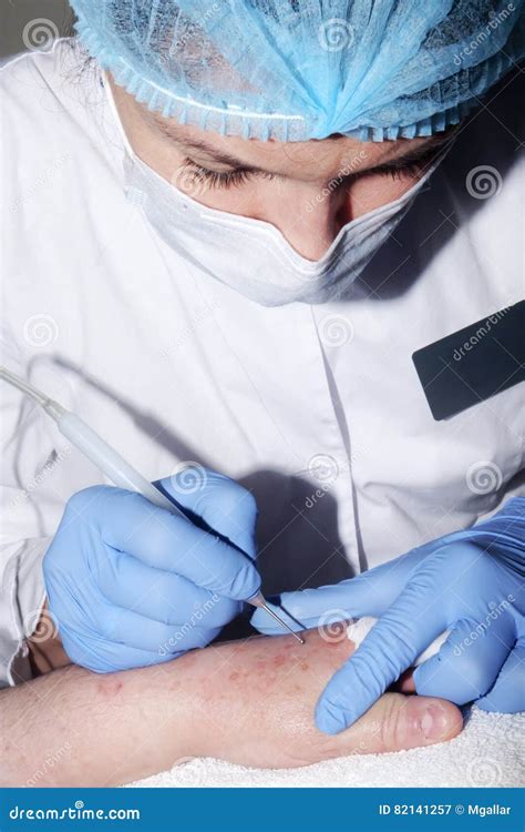 Microsurgery Doctor Removes Skin Disease Stock Image Image Of