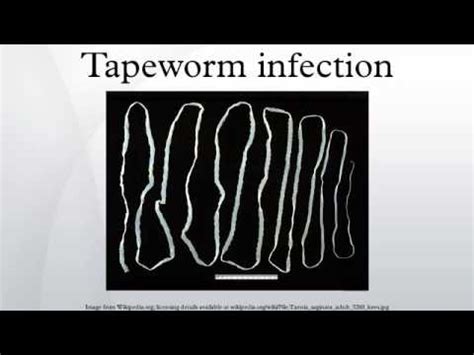 Tapeworm Infection