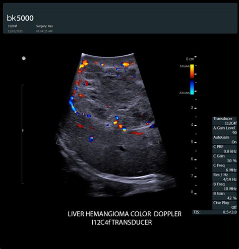 Bk Surgery Ultrasound Machine Bk Medical