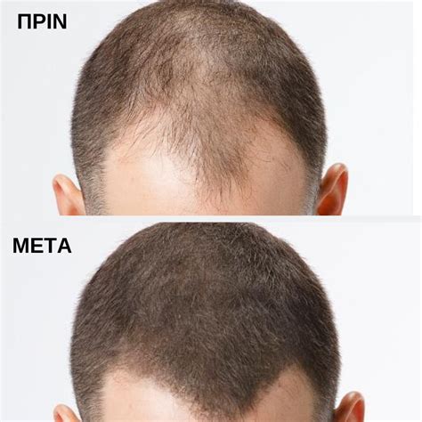 Toppik Hair Building Fibers Grey 12gr Προσφορές Mallia