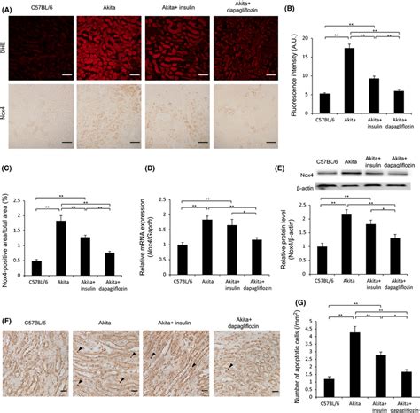 Dapagliflozin Suppresses Oxidative Stress And Apoptosis In The Kidney