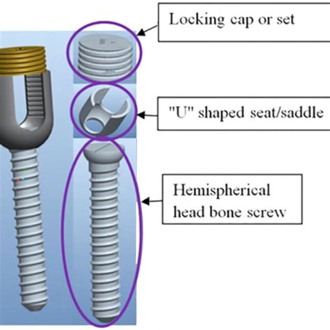 Pedicle Screw And Its Components Download Scientific Diagram