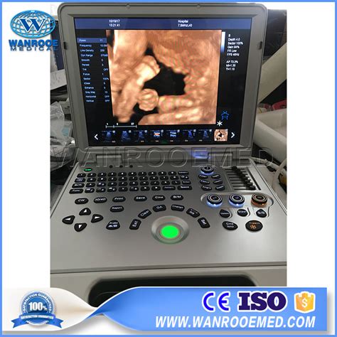 Usc Plus Medical D Full Digital Diagnostic Color Doppler Ultrasound