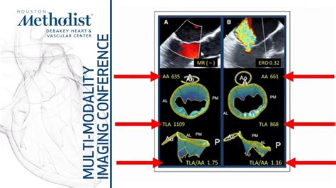 Multi Modality Case Presentations By Advanced CV Imaging Fellows